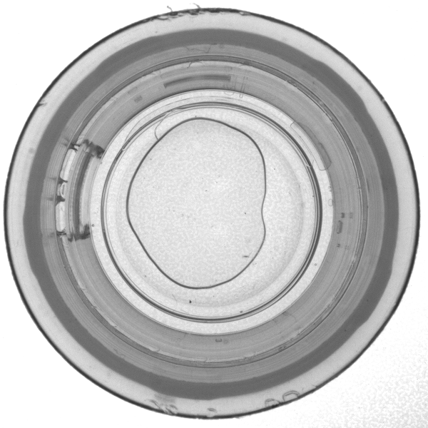 隱形眼鏡眼膜氣泡檢測